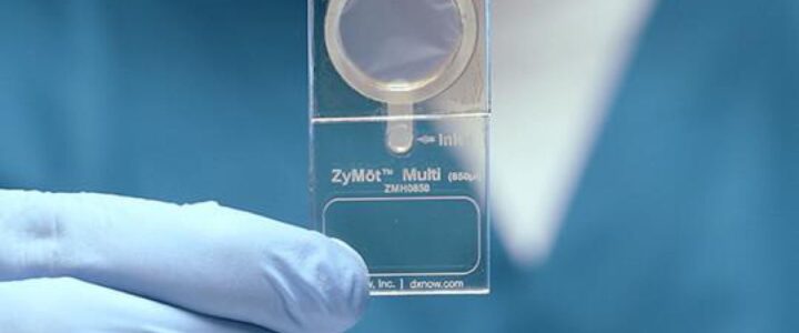 Technologie ZyMōt ® : Révolutionnant la Sélection des Spermatozoïdes
