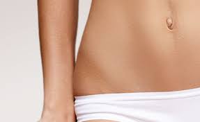 Chirurgie esthetique diastasis abdominal Tunisie