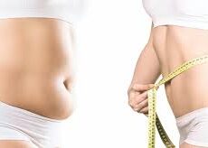 Liposuccion 1 Zone ou 2 Zones + Abdominoplastie