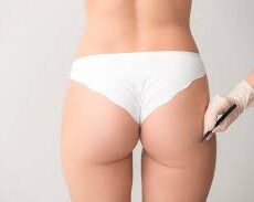 Prix Chirurgie Esthétique lifting des fesses Tunisie