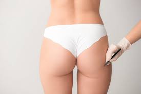 Prix Chirurgie Esthétique lifting des fesses Tunisie