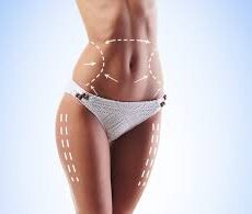 Prix Chirurgie Esthétique Liposuccion 360 en Tunisie