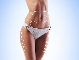 Prix Chirurgie Esthétique Liposuccion 360 en Tunisie