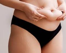 BBL et abdominoplastie en même temps