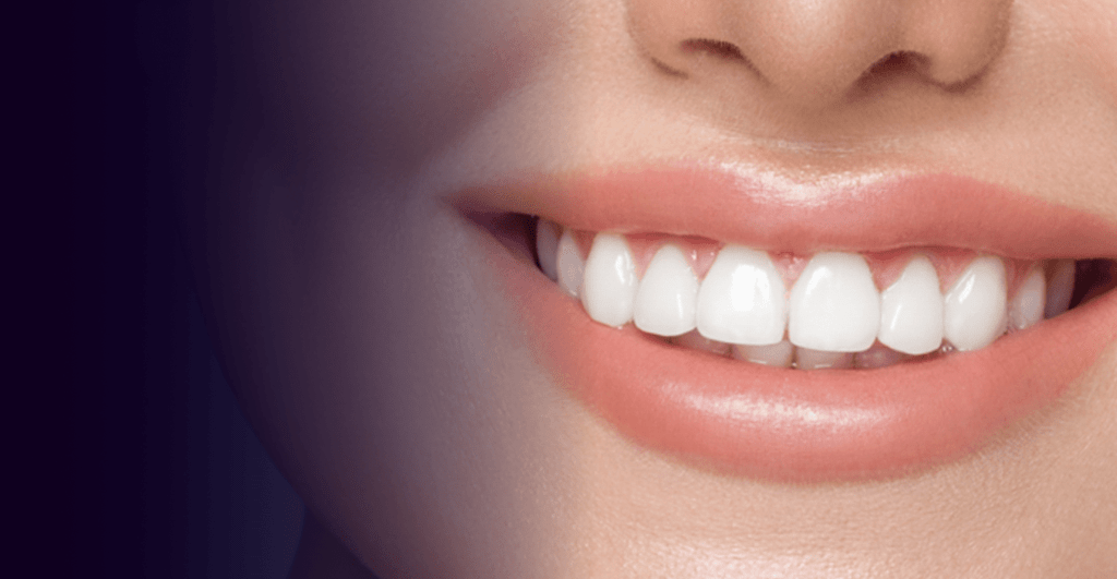 teeth whitening dubai