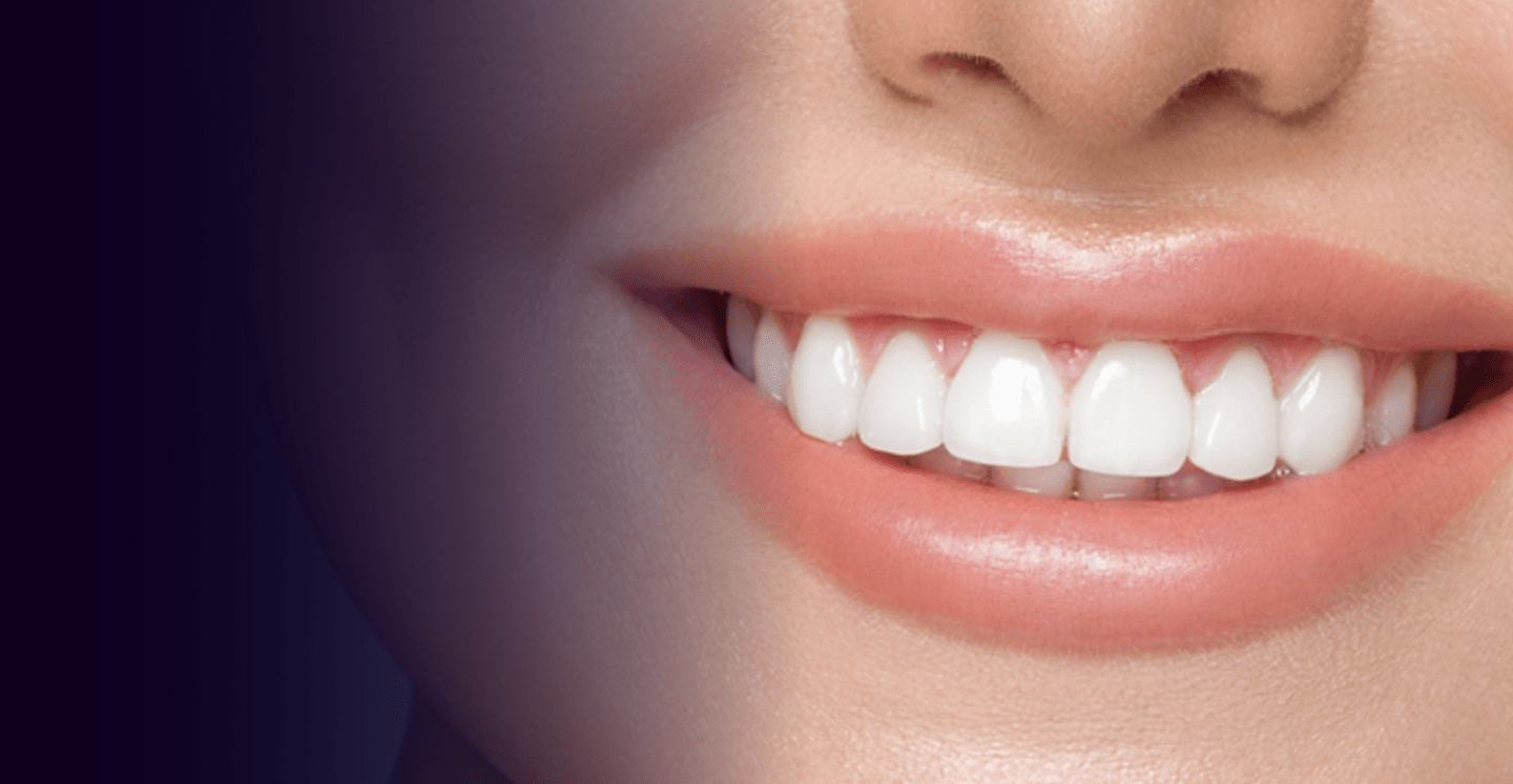 Teeth whitening in Dubai : Price, Cost and treatments