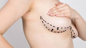 lipofilling seins dubai